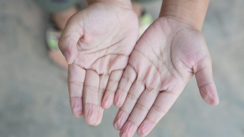 Parmaklar Suda Neden Buruşur?